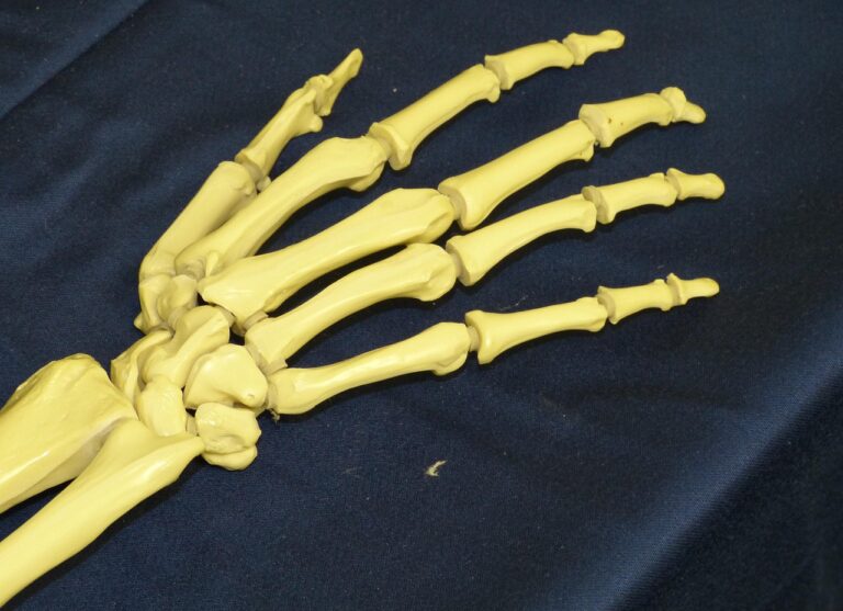 Osteopur